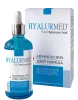 HYALURMED Reine Hyaluronsäure 100 ml